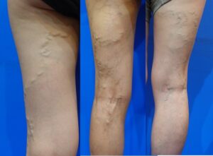 使ってみました 妊娠中～産後におすすめの着圧ソックス10選。足のむくみに悩むママ&妊婦さん必見選りすぐリストのレコメンドサイト edimo