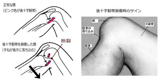 アザにはアロマスクール ラヴァーレ