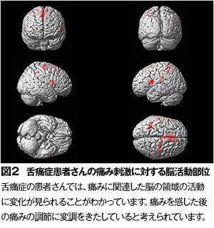 舌が痛い小嶋デンタルクリニック