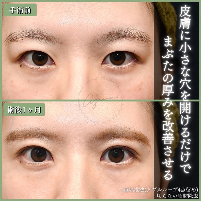 一重メイク 腫れぼったくならないピンクメイク🌷一重まぶたをスッキリ見せるポイント☝🏻