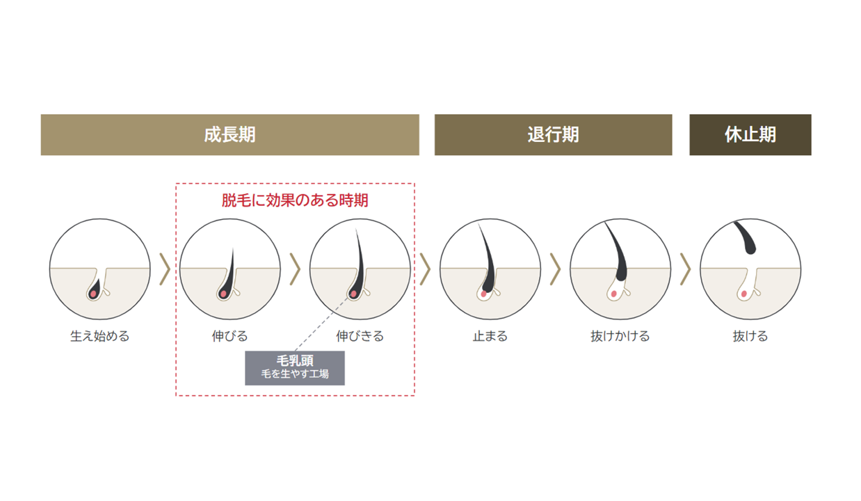 毛髪の生え替わり ヘアサイクル とは？ -薄毛対策講座- - 薄毛・抜け毛対策に！視覚的に増毛が可能なスーパーミリオンヘアー SMH