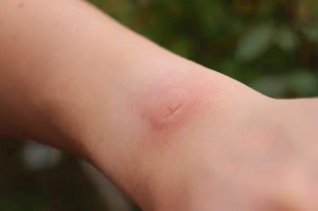 マダニに寄生された犬の治療について山の辺いぬねこクリニック