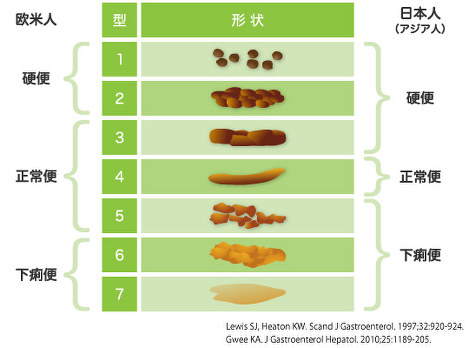 ウンチの色や臭いは何で決まる？ 真面目に学ぶ大人のウンチ学