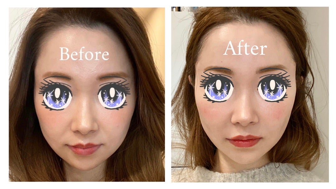 トゥヴェールのレチノールを1カ月使ってみた レチノショット 口コミ - つれづれ美容