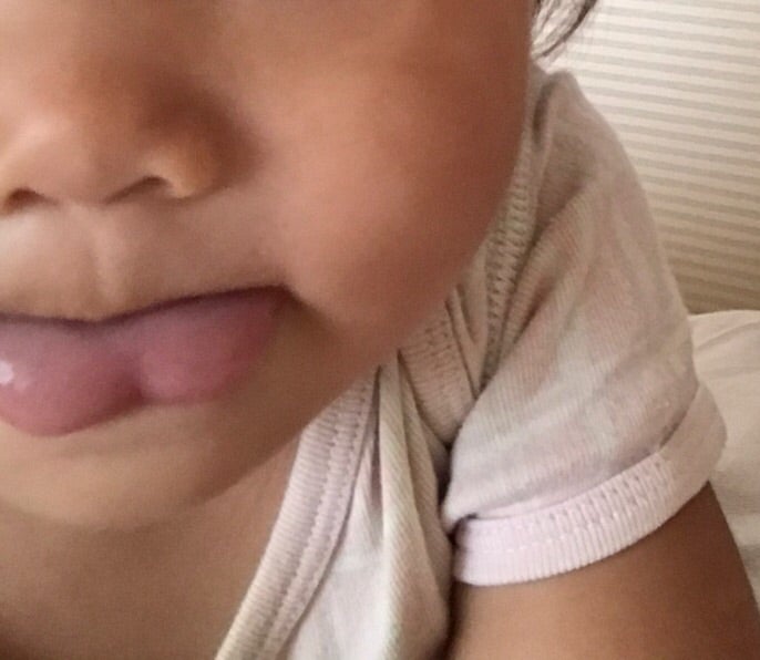 スプリットタン名古屋中央クリニック 美容外科・美容皮膚科