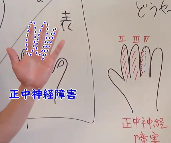 腕・手の痛みやしびれ 岐阜市・岐南町しみず整形外科リハビリクリニック