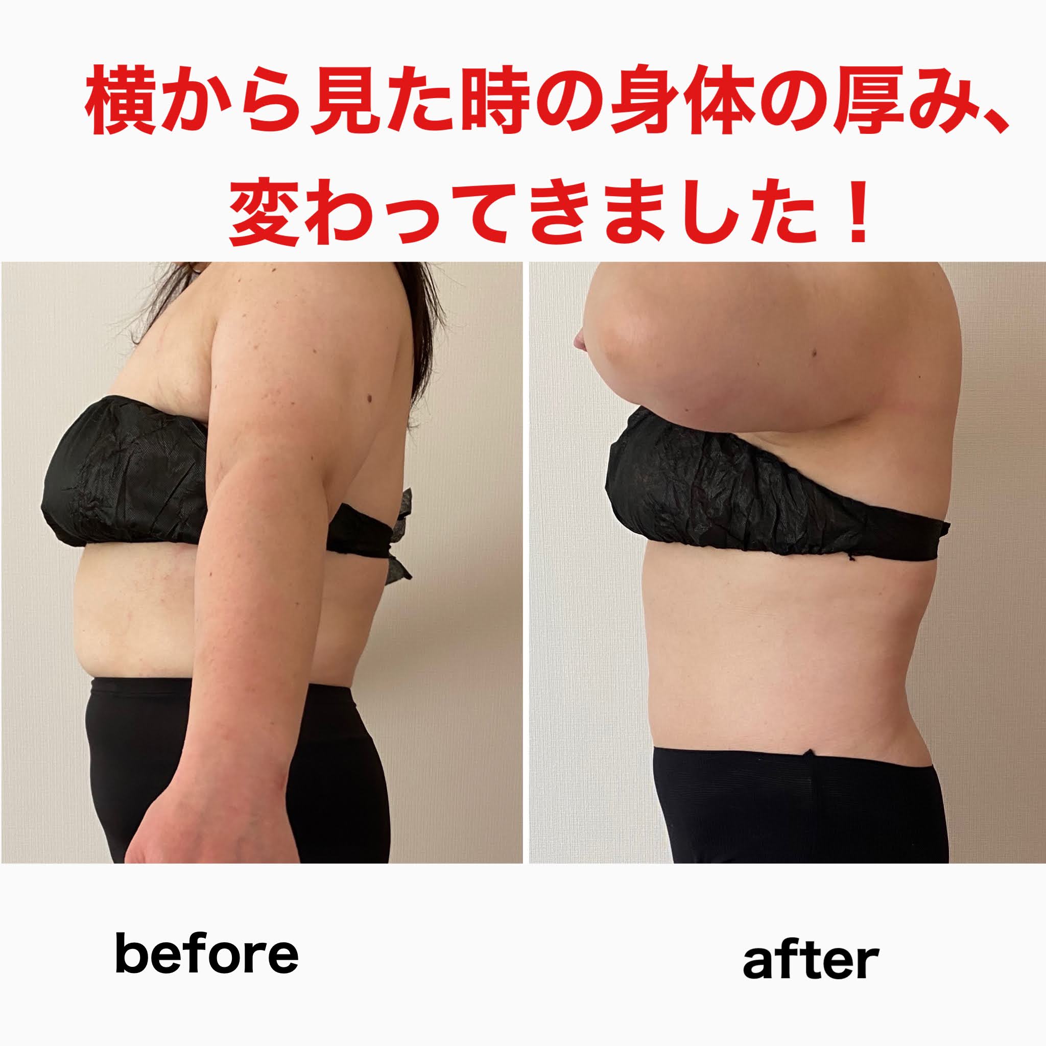 姿勢のゆがみでぽっこりお腹や垂れ胸に！原因と対策をイラストで解説 : 読売新聞