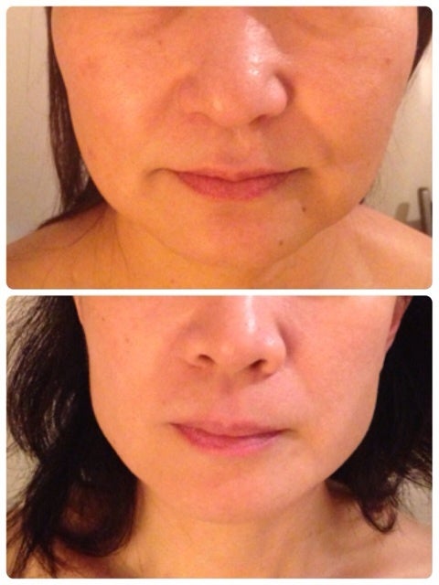 下膨れ悩みを解消する「髪型のポイント」と「おすすめスタイル16選」美的.com