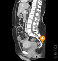 腰痛とは？その種類と原因、治療について天神橋筋六丁目 天六 駅の整形外科天6整形外科