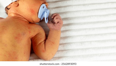 新生児黄疸は何故起こる？赤ちゃん成長ナビ 小児科専門医師 監修