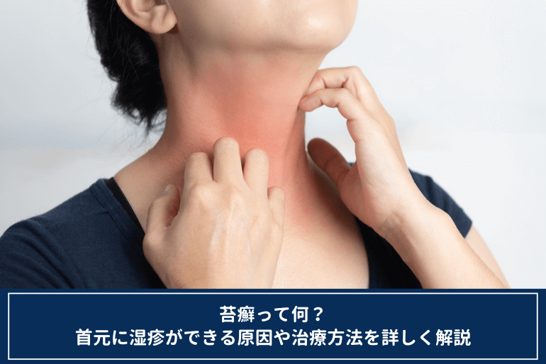 毛孔性苔癬 もうこうせいたいせん こばとも皮膚科栄駅 名古屋市栄区 徒歩2分