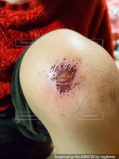 怪我をした人 イラスト素材4180742- フォトライブラリ