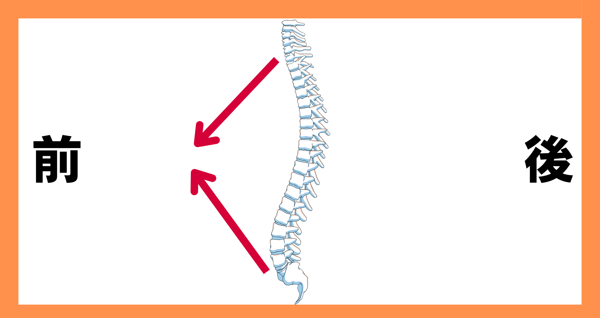 原因不明と言われた腰から脚にかけての酷い痛み 腰椎終板炎、棘間靭帯炎、仙腸関節障害- なごやEVTクリニック