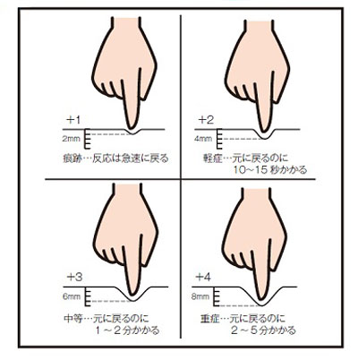 ばち状指 文字あり のイラスト素材102342900- PIXTA