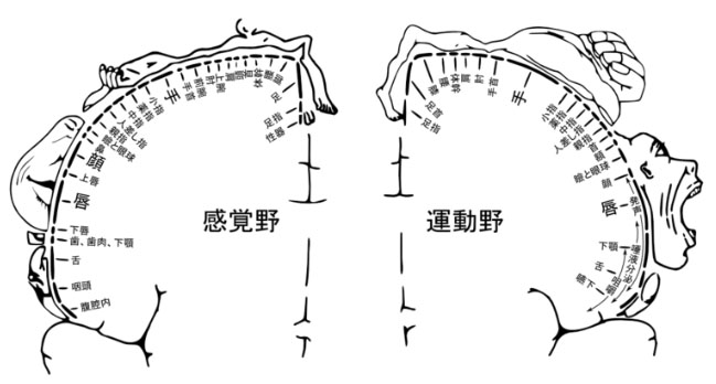 上肢単独麻痺を呈する脳血管障害│医學事始 いがくことはじめ