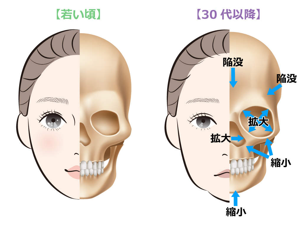 🟢頭蓋骨の老化による変化🟢Raplit