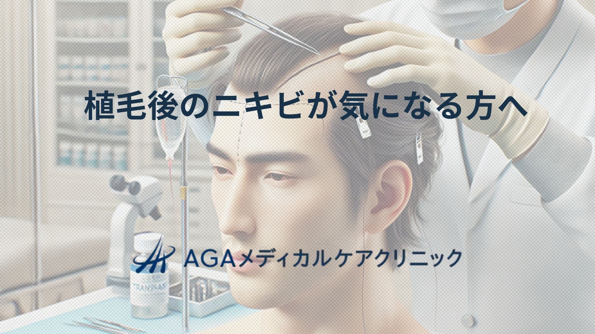 髪の生え際にニキビは何のサイン？生え際ニキビができる原因、ケア方法を紹介薄毛治療・AGAならAGAナビアイメッド
