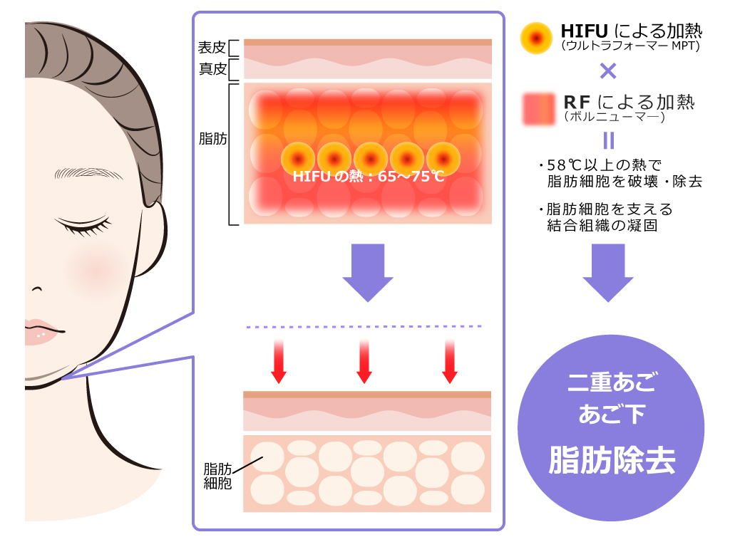 スッキリ体質改善ファスティング オンラインファスティングサポート