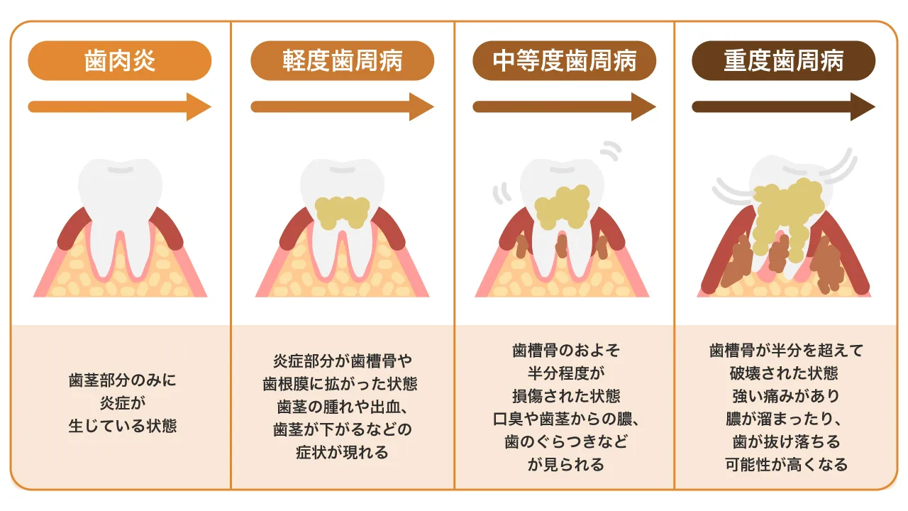 お疲れフェイスには顔コリほぐし！ケア方法紹介ホットペッパービューティーマガジン