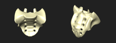 仙骨裂孔 - e-Anatomy - IMAIOS