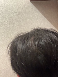 つむじが2つある原因とは！？おすすめの髪型も知っておこう！薄毛対策室 バイオテック 株式会社バイオテック