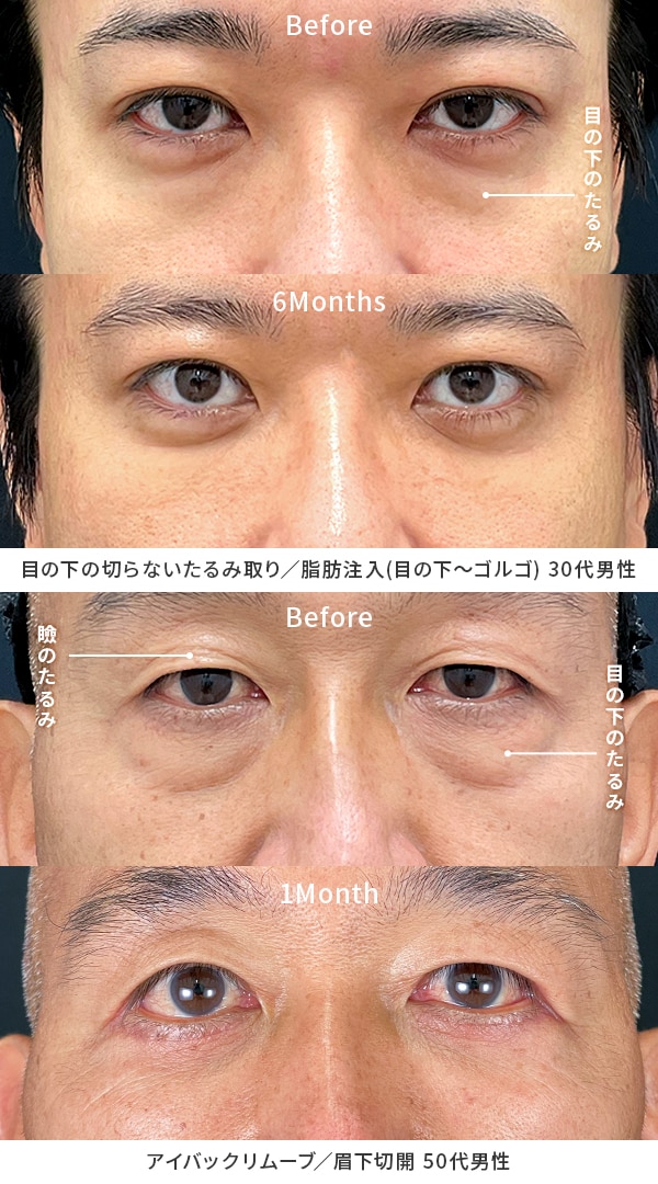 老け顔の男性は本当にモテない？原因と改善策、若見えテクを解説マシェラボ