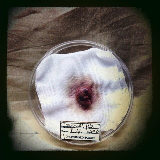 Amazon.co.jp: 解剖模型 骨格模型 妊婦下半身模型、二胎児、臍帯胎盤 妊婦健康診査、助産、出産のための総合演習 その他スキル :産業・研究開発用品