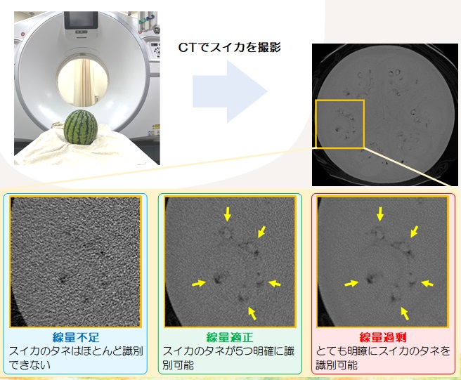CT画像あり 脾損傷とは？分類・症状・治療の徹底まとめ