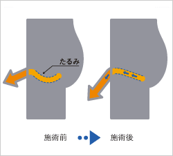 【ちんちんのサイズ】日本人男性のリアル平均を模型で解説