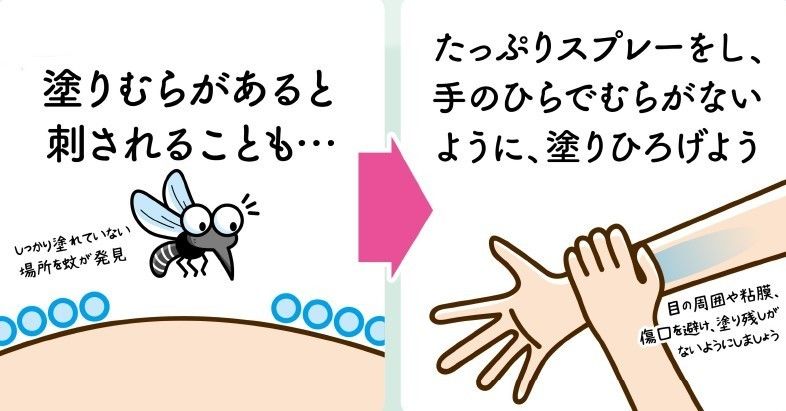 蚊はなぜ刺すのか？かゆいだけじゃない、蚊の驚きの目的とは