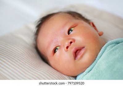 新生児黄疸はなぜ起こる？治療は必要？原因と仕組みについて小児科の専門医が解説 - YouTube