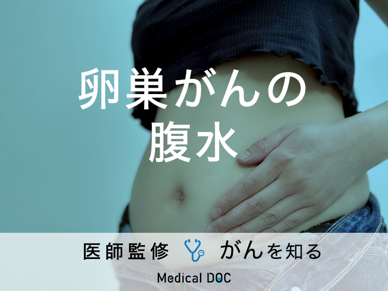 がんで腹水がたまってしまったときの余命は？ 腹水の治療法や同時に検討したいがん治療がん患者様のためのお役立ちブログ6種複合免疫療法