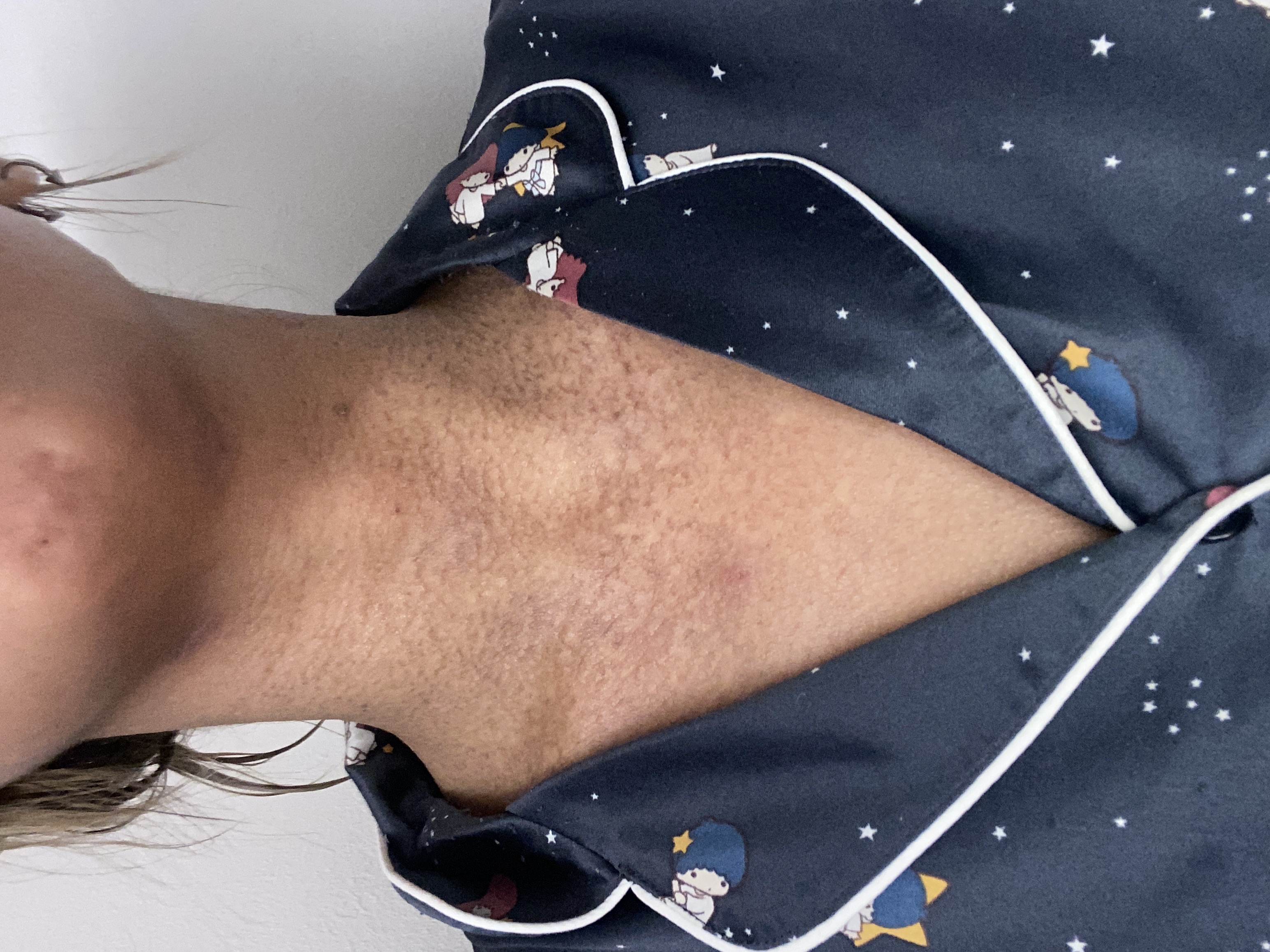 隠すサポーター サポーター はだいろ タトゥー隠し 手首サポーター はだ色 かくす 刺青隠し 隠し肌かくし リスカ跡 リストカット跡 傷跡 薄型Pay ID