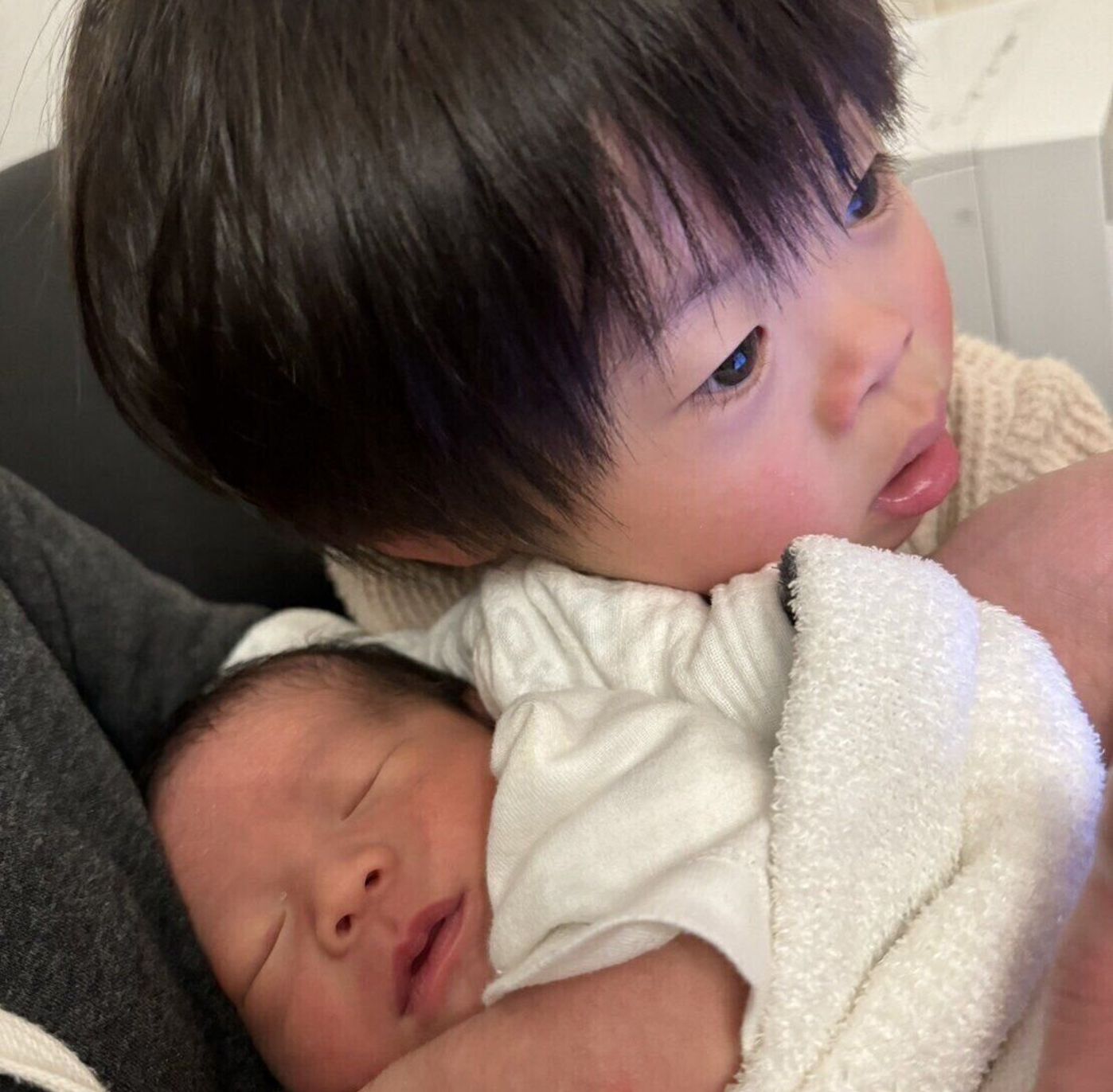 ダウン症の顔 無邪気な顔の毛 写真 無料ダウンロードのための画像 - Pngtree