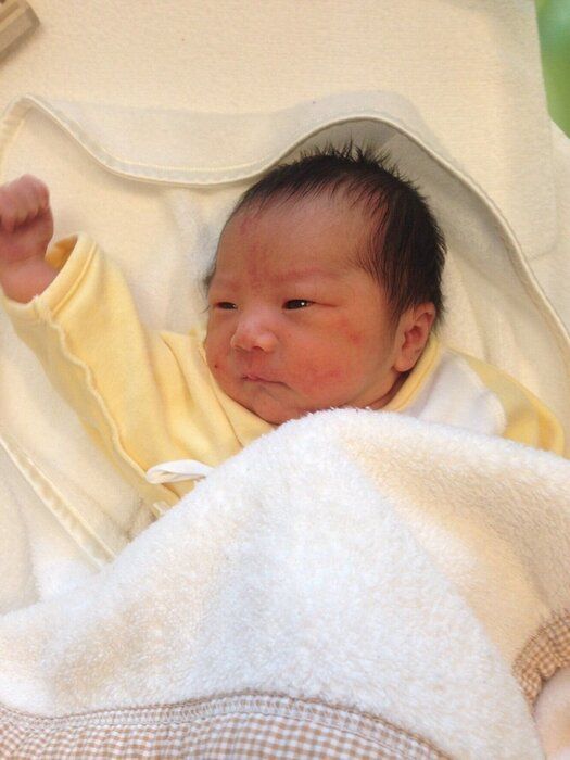 赤ちゃんの頭のかたちで悩み続けるなら月齢の早いうちに医療機関で診断を！ - 赤ちゃんの頭のかたち相談室