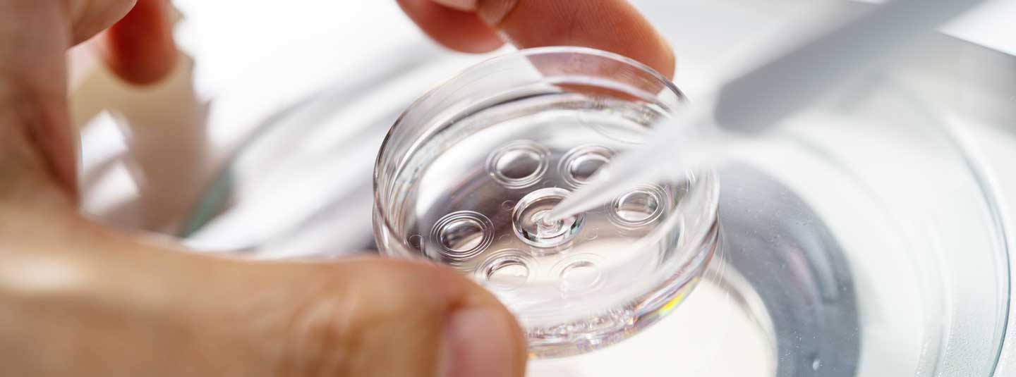 培養室から ・胚培養 - 大阪の体外受精・不妊治療専門なかむらレディースクリニック