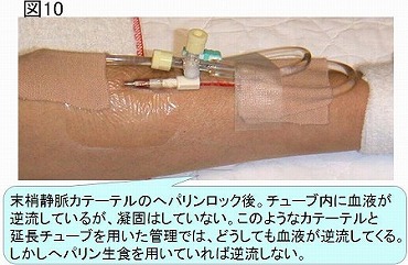 採血練習に必要な道具 - sensitiv®について - お役立ち情報 -公式採血練習キットsensitiv® センシティブ