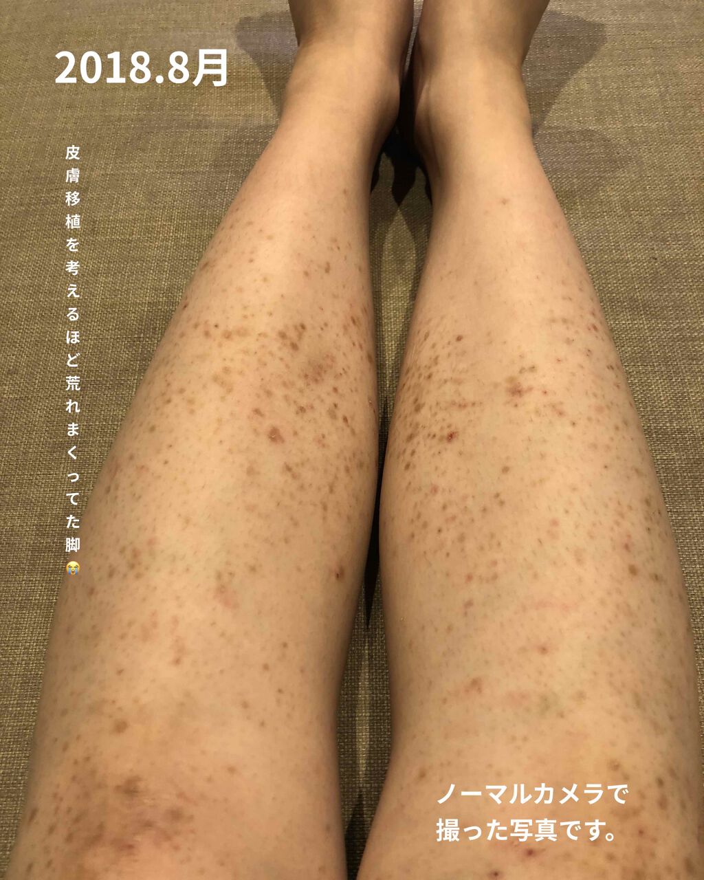 薬用ローション カミソリ負け防止スキンケア商品情報・使い方LUCIDO - ルシードmandom