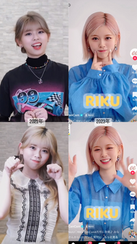 NiziU リク歯列矯正ビフォーアフターの結果は驚くべきですTikTok