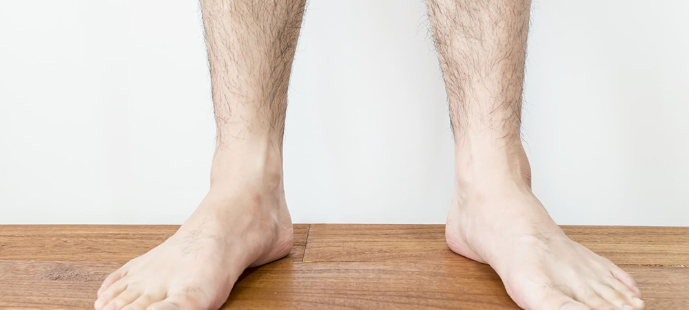 毛深い男性ははげるは本当？薄毛と男性ホルモンの関係-AGA薄毛予防治療クリニック