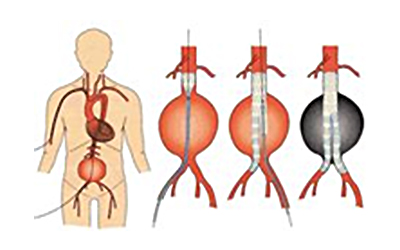 胸大動脈イラスト無料イラスト・フリー素材なら「イラストAC」