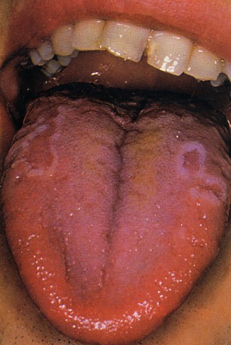 大脳辺縁系のおはなし前帯状皮質帯状回扁桃体視床視床下部海馬歯状回脳弓乳頭体海馬傍回側坐核 - Akira Magazine