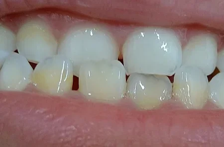 予防・クリーニングきたやま歯科・矯正歯科・こども歯科クリニック