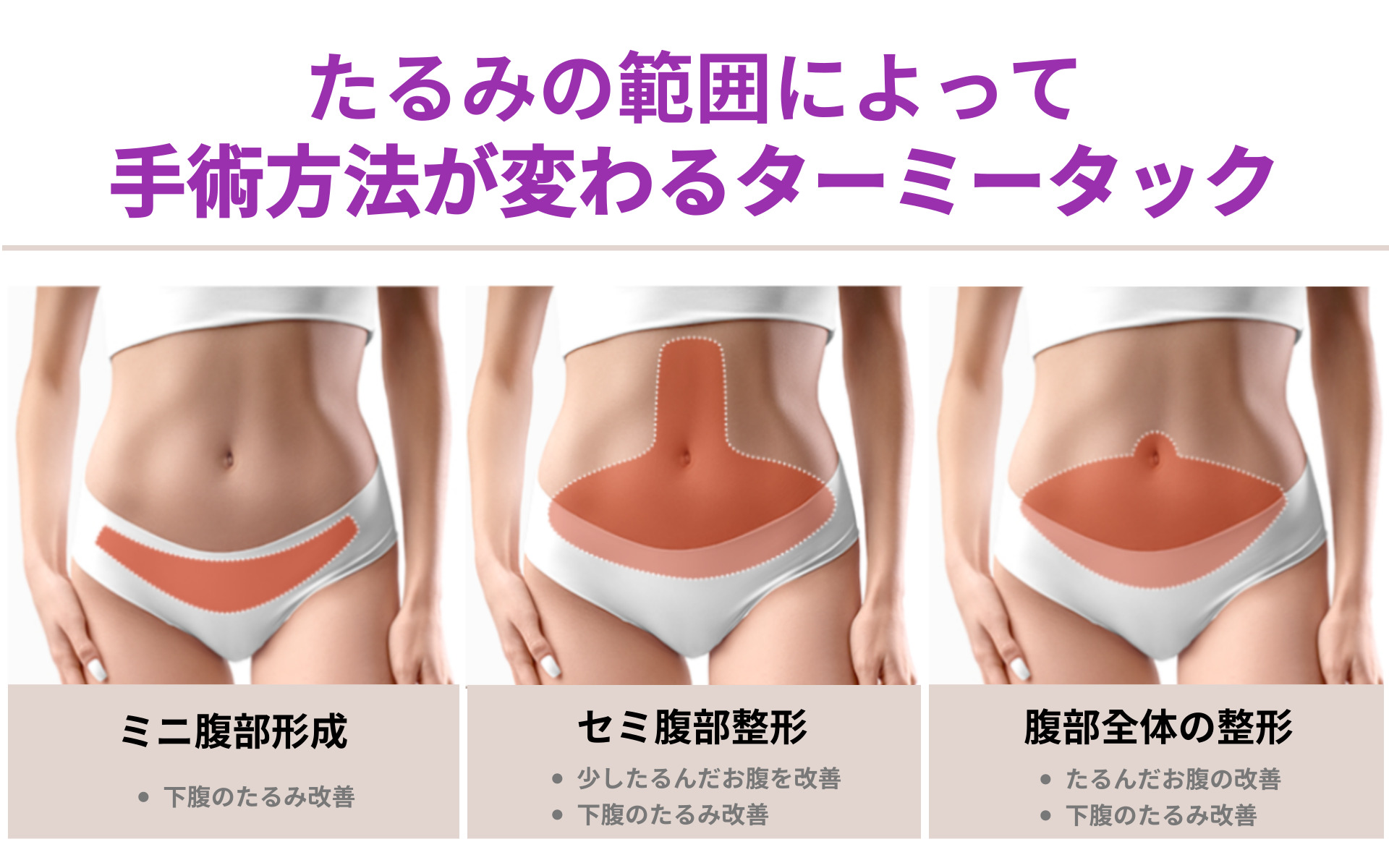 産後の下腹のたるみ解消法2025 年のリアルなLemon8ユーザー体験