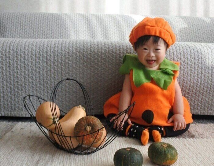 ダウン症の赤ちゃんの特徴顔立ちと症状 - 新型出生前診断 NIPT Japan