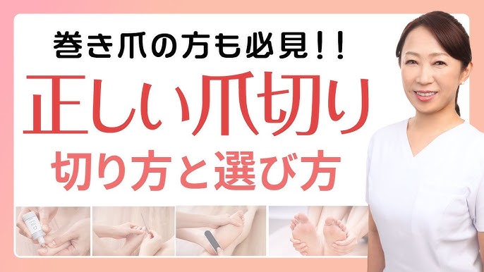 巻き爪の正しい切り方 画像付き解説 自分で足の爪を切れるようになろう！ながい接骨院