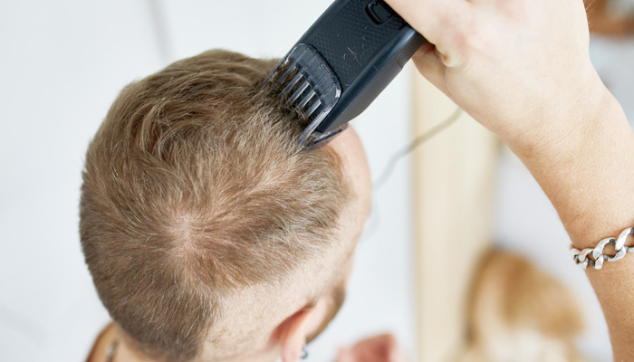 薄毛 はげ の人が坊主にする時に気をつけたいこと！似合わない理由を徹底調査！ヘアスタイル・髪型のお悩み