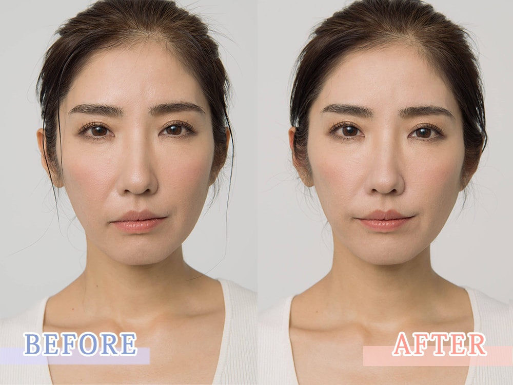 頭を揉んで頭が小さくなる？！大人の自由研究報告