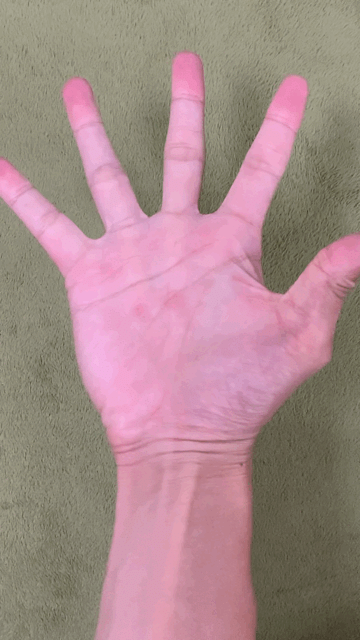 手に力が入らない原因・病気やす整形外科クリニック