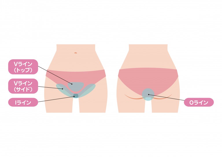 ハイジニーナ脱毛は後悔する？7つのメリットとデメリットを解説SELFMADE 総合TOP
